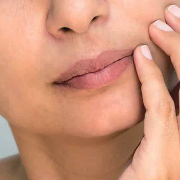 Person with dull skin