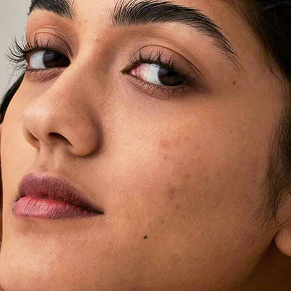 Person with skin pigmentation